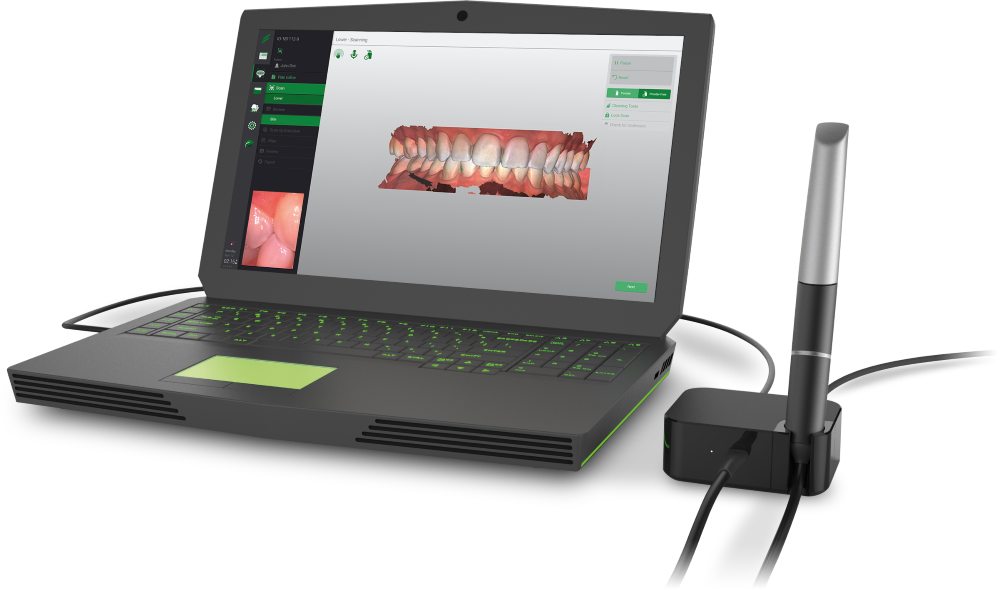 Digital smile design Ripon. Intra-oral scanner
